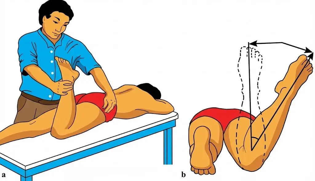 Craig's Test (Ryder Method) Orthopedic Special Test