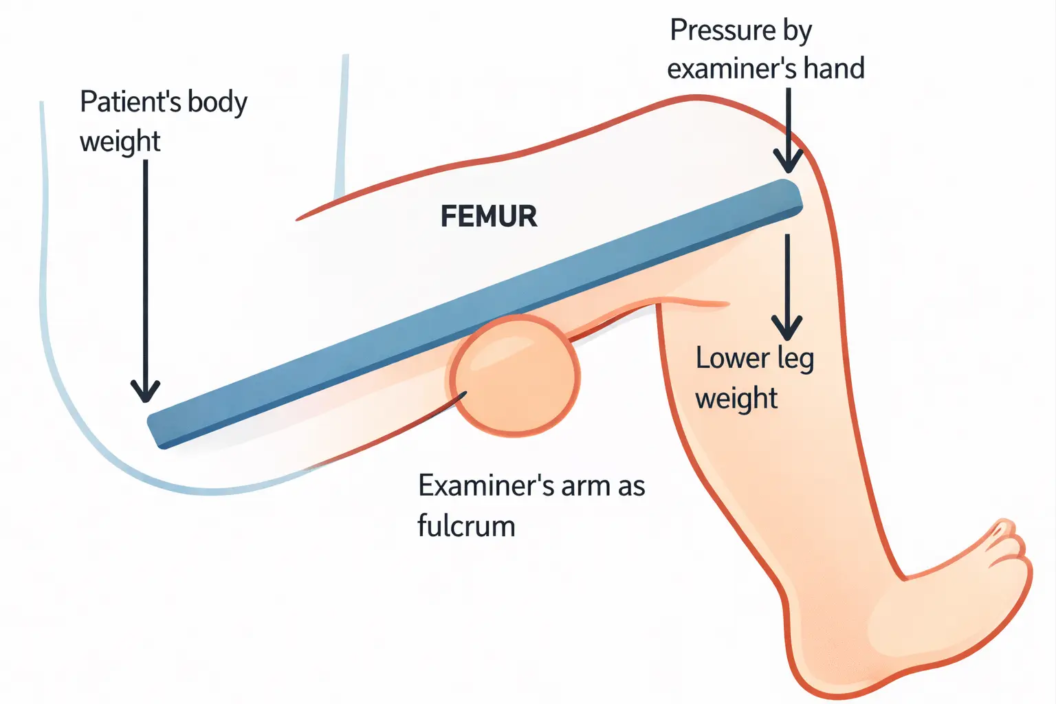 Fulcrum Test Orthopedic Special Test