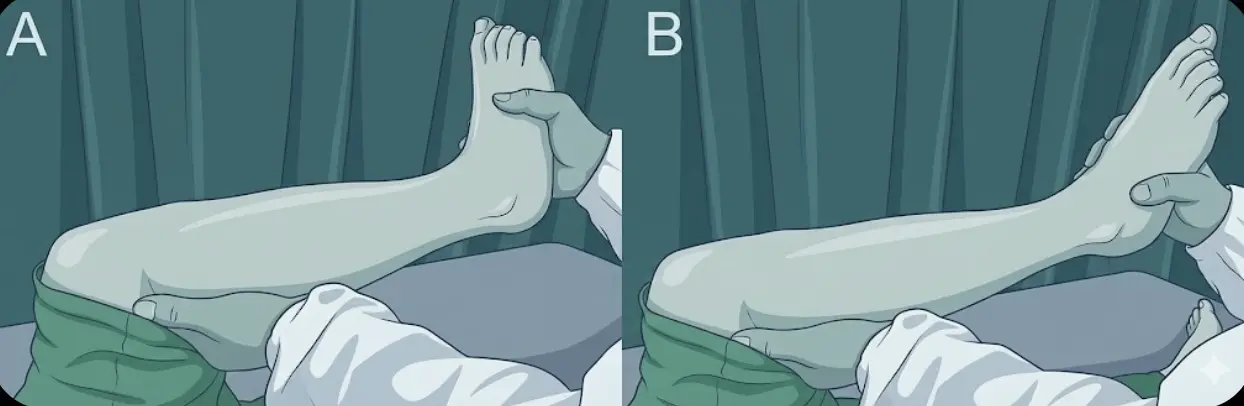 Garrick Test Orthopedic Special Test