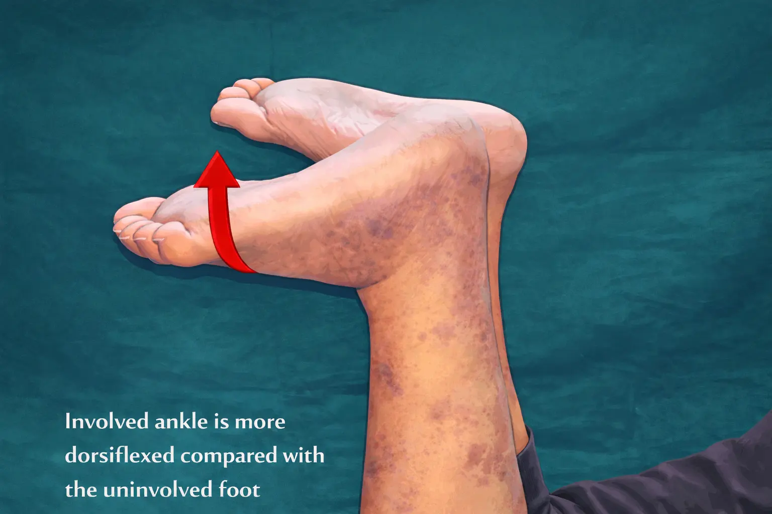 Matles Test Orthopedic Special Test