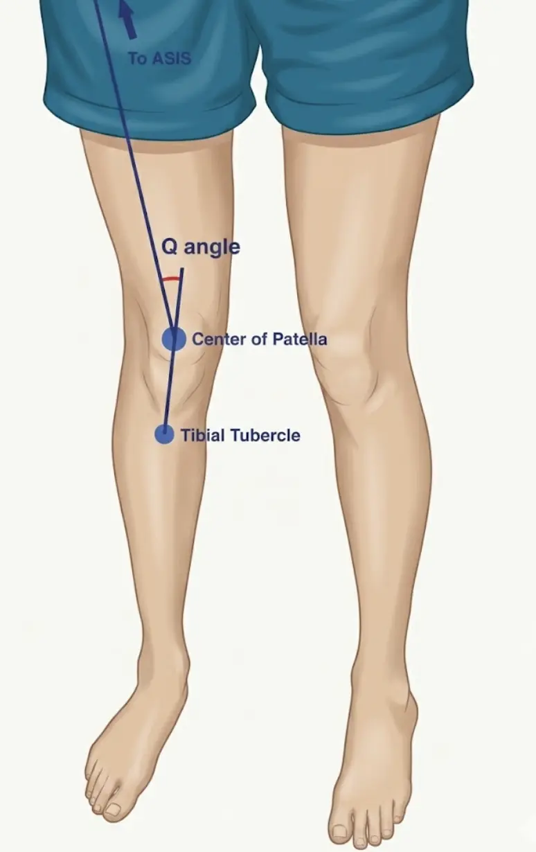 Q-Angle Measurement Orthopedic Special Test
