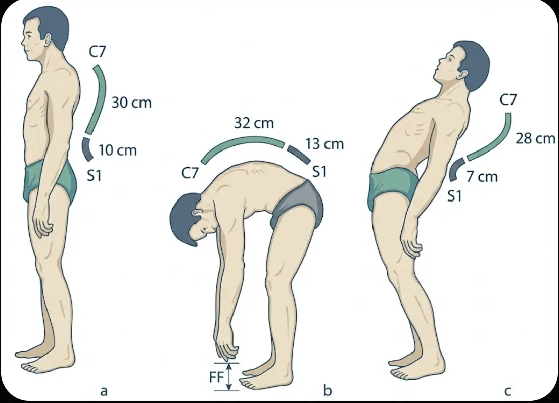 Schober Sign Orthopedic Special Test