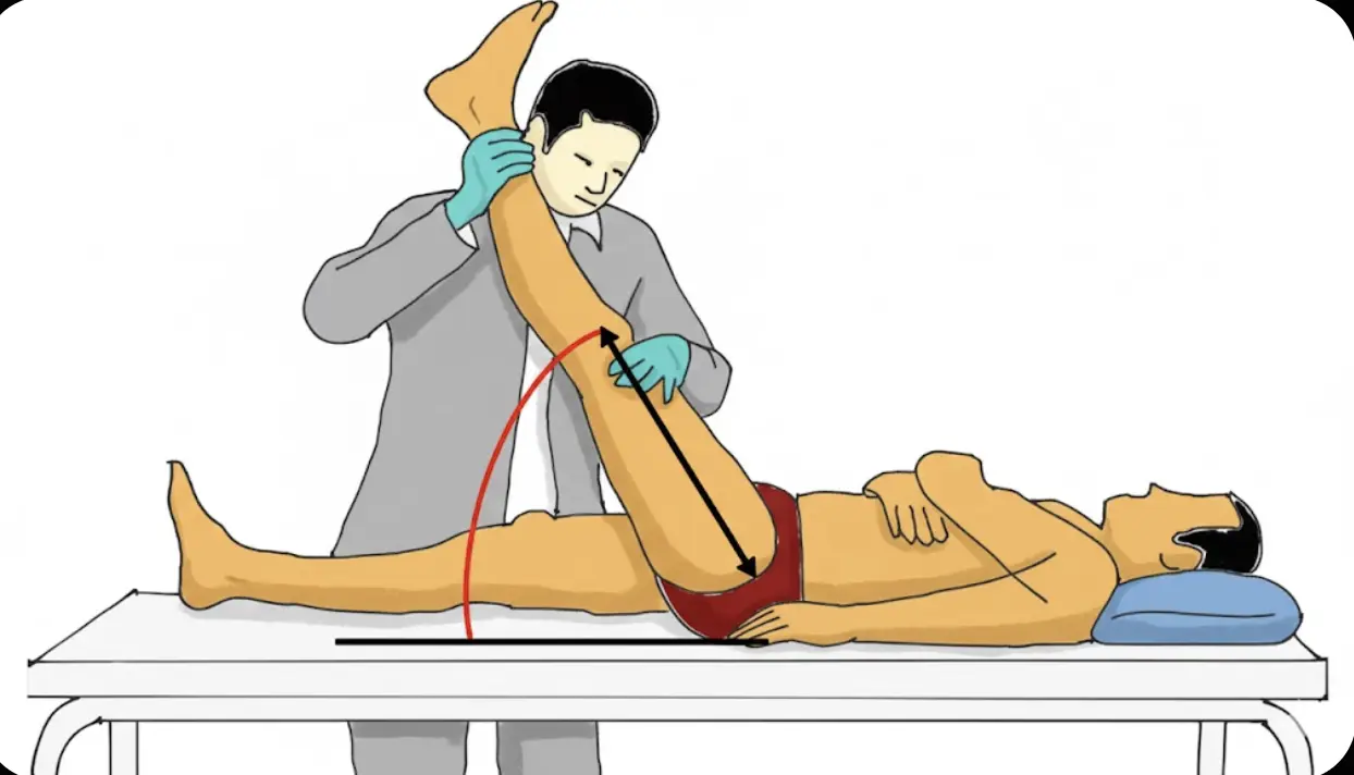 Lasegue Test (Straight Leg Raise) Orthopedic Special Test