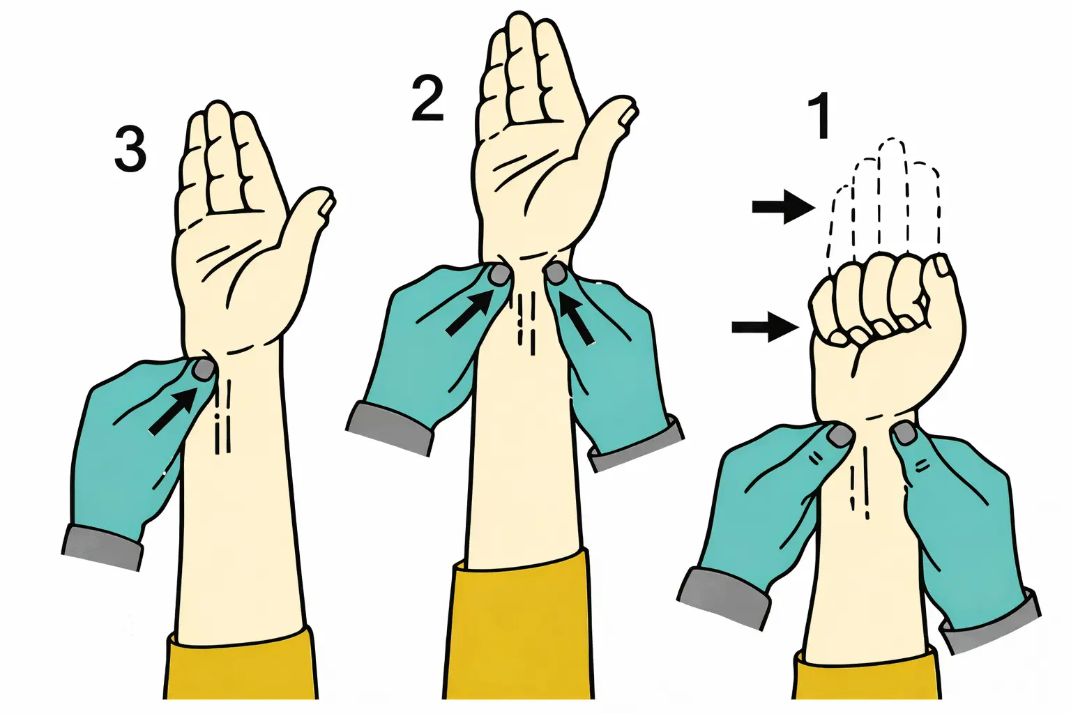 Allen Test (Vascular) Orthopedic Special Test