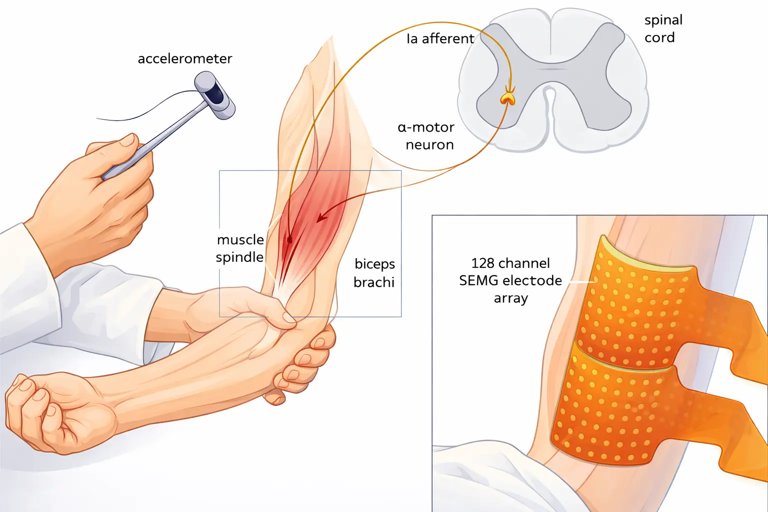 Biceps Reflex Test Orthopedic Special Test