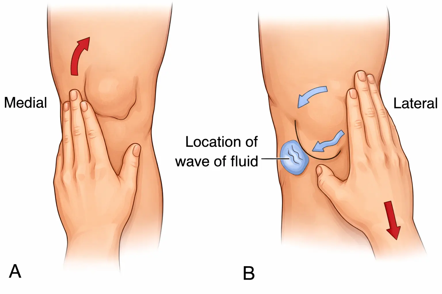 Brush / Stroke Test (Swipe Test) Orthopedic Special Test
