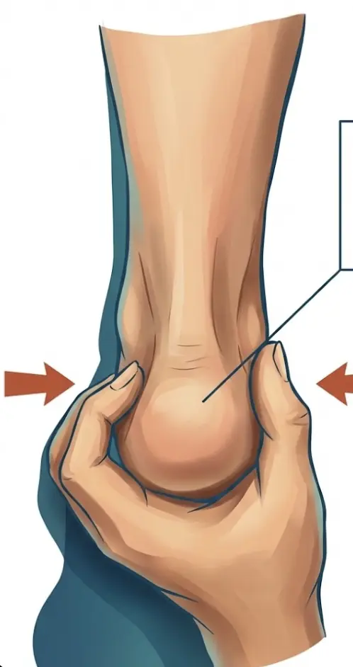 Calcaneal Squeeze Test Orthopedic Special Test