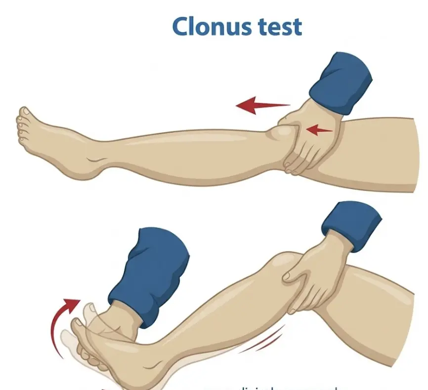 Ankle Clonus Test Orthopedic Special Test