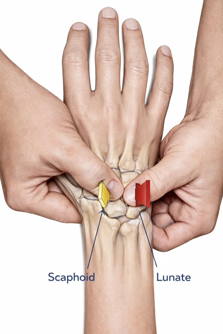 Lunotriquetral Ballottement Test Orthopedic Special Test