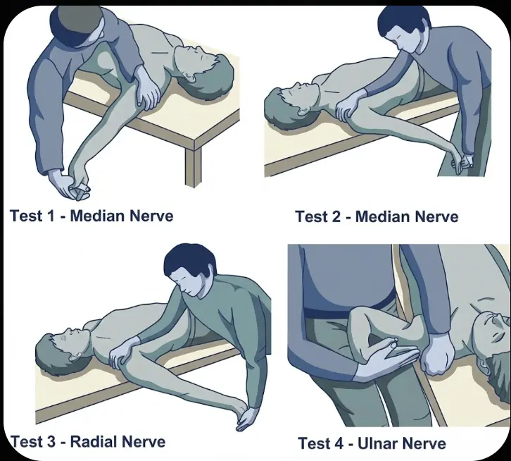 Elvey Test (Upper Limb Tension Test) Orthopedic Special Test