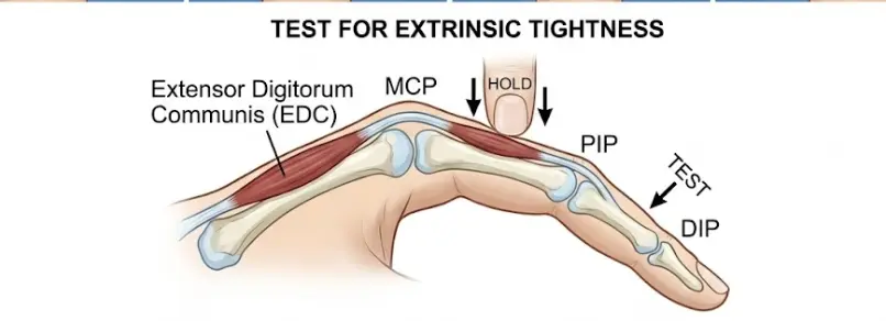 Test for Extrinsic Tightness Orthopedic Special Test