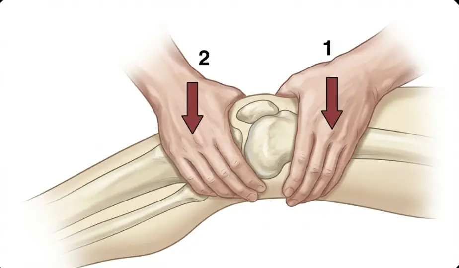 Fluctuation Test Orthopedic Special Test