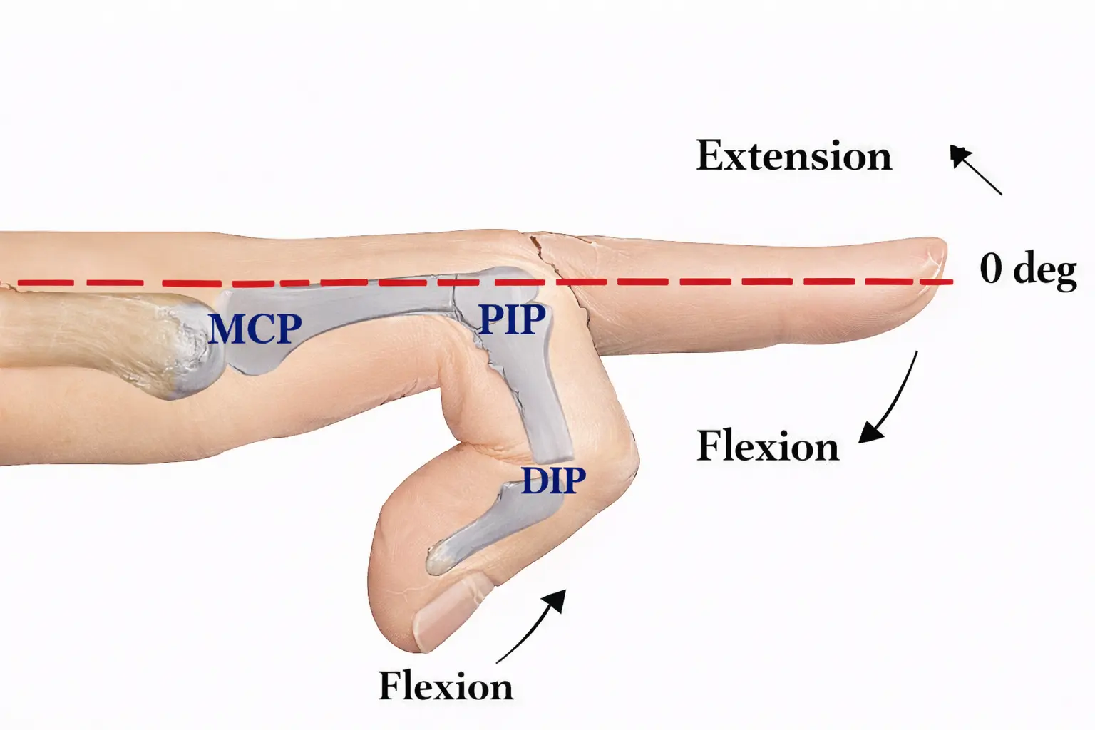 Hand Range of Motion Orthopedic Special Test
