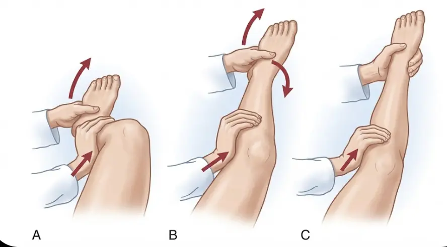 Jerk Test of Hughston Orthopedic Special Test