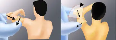 Kim Test Orthopedic Special Test