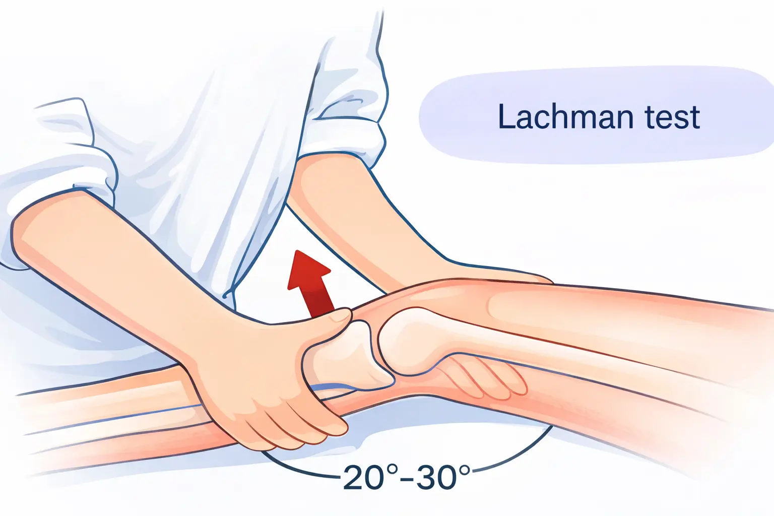 Lachman Test Orthopedic Special Test