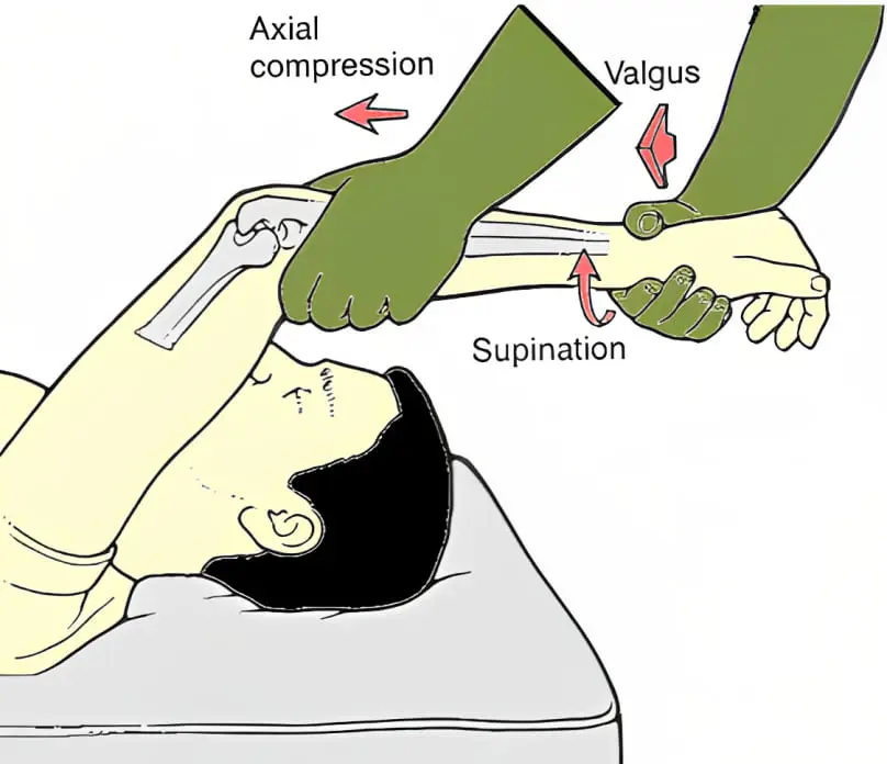 Elbow Lateral Pivot-Shift Test Orthopedic Special Test