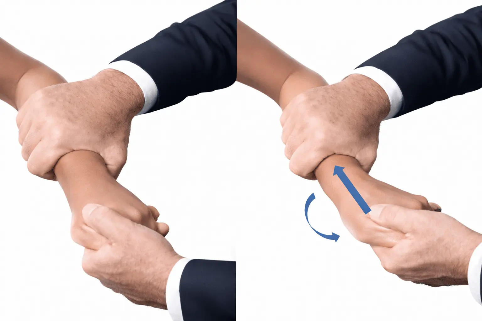 Lichtman Test Orthopedic Special Test