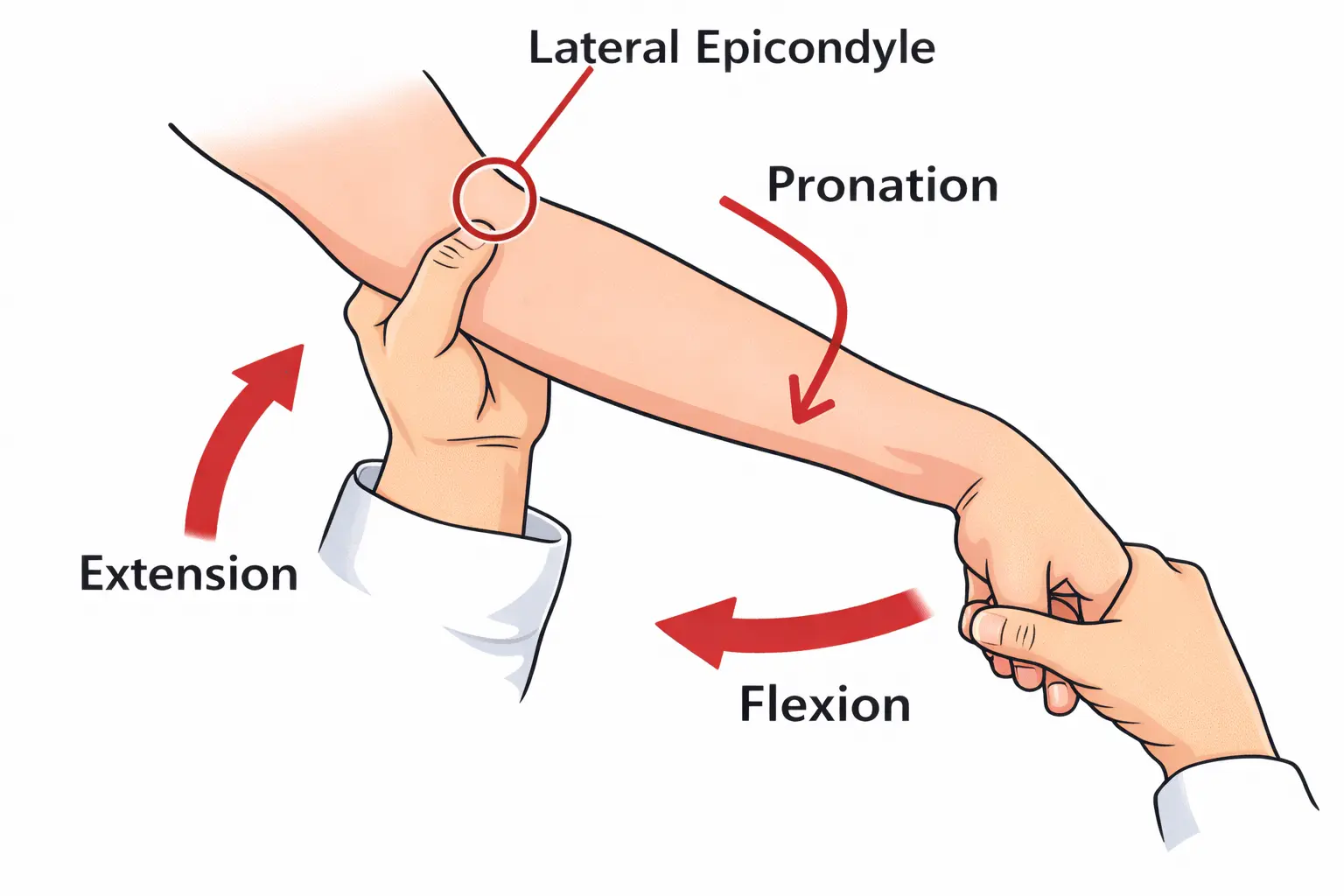 Mill's Test Orthopedic Special Test