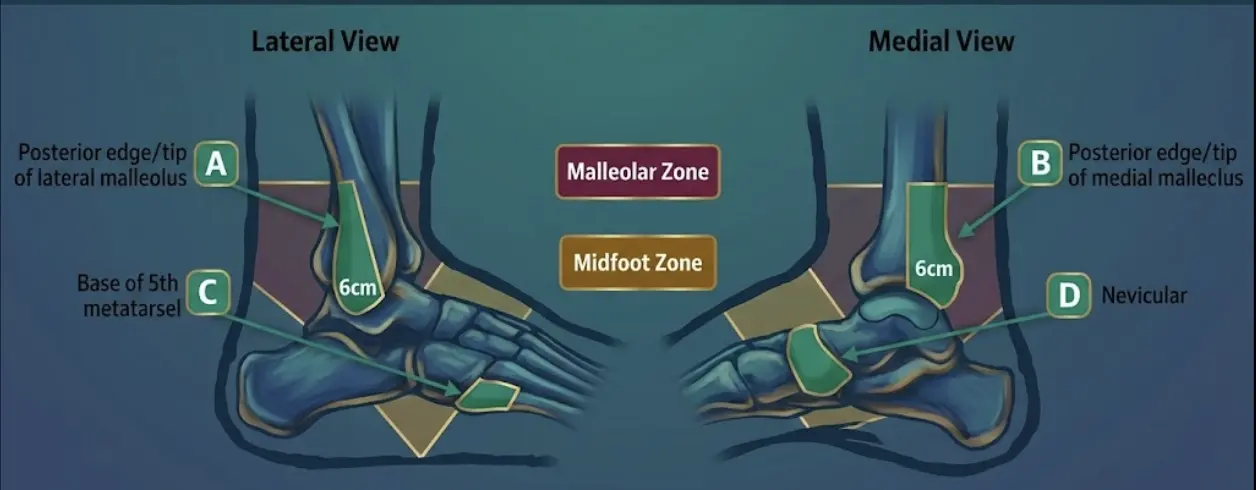 Ottawa Ankle Rules Orthopedic Special Test