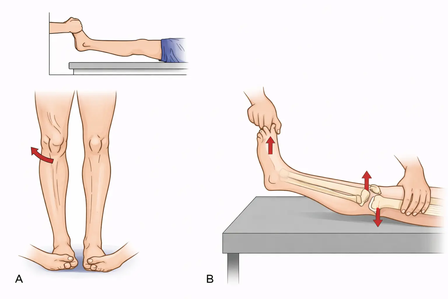 External Rotation Recurvatum Test Orthopedic Special Test