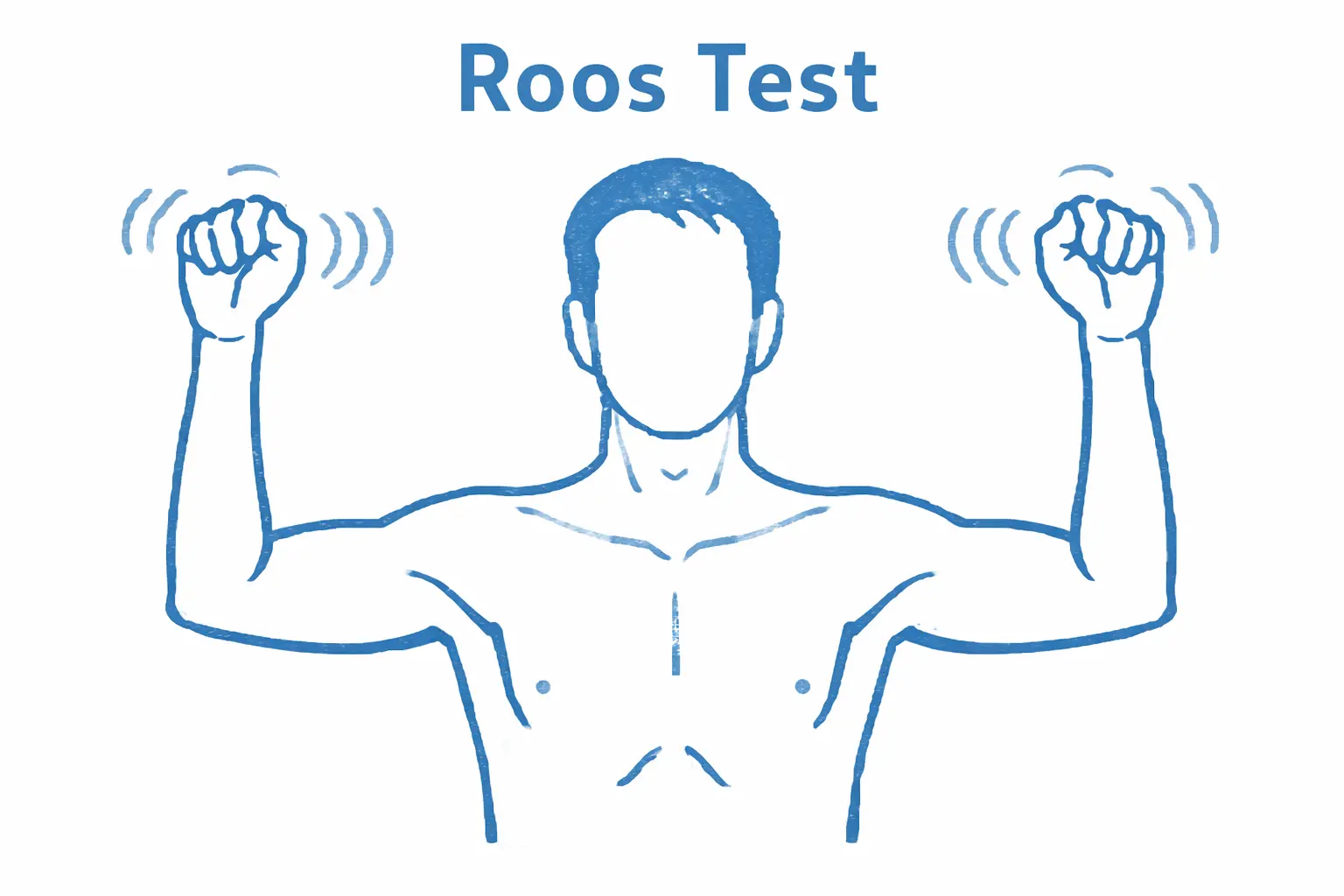 Roos Test (EAST) Orthopedic Special Test