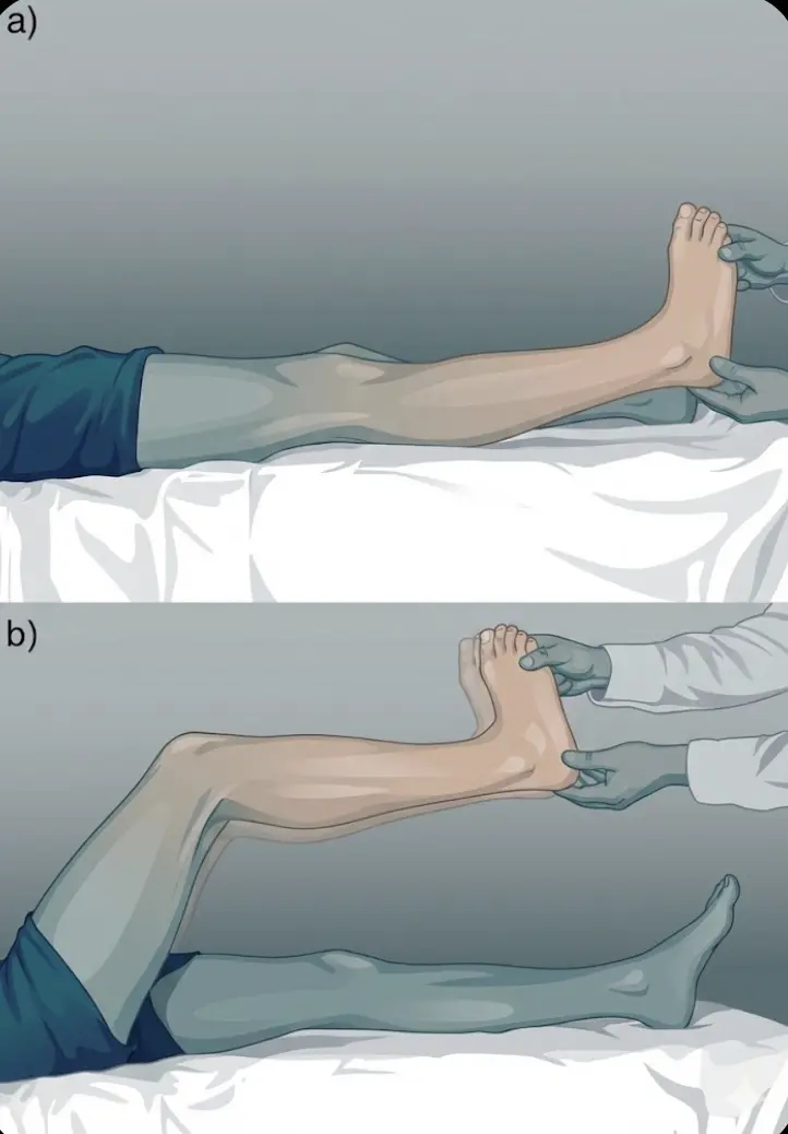 Silfverskiöld Test Orthopedic Special Test