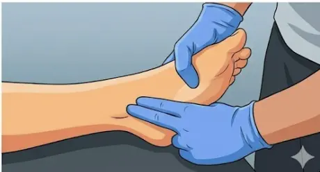 Triple Compression Stress Test Orthopedic Special Test